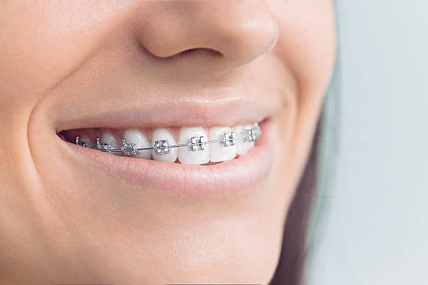 Laser Dentistry in Excelsior, MN